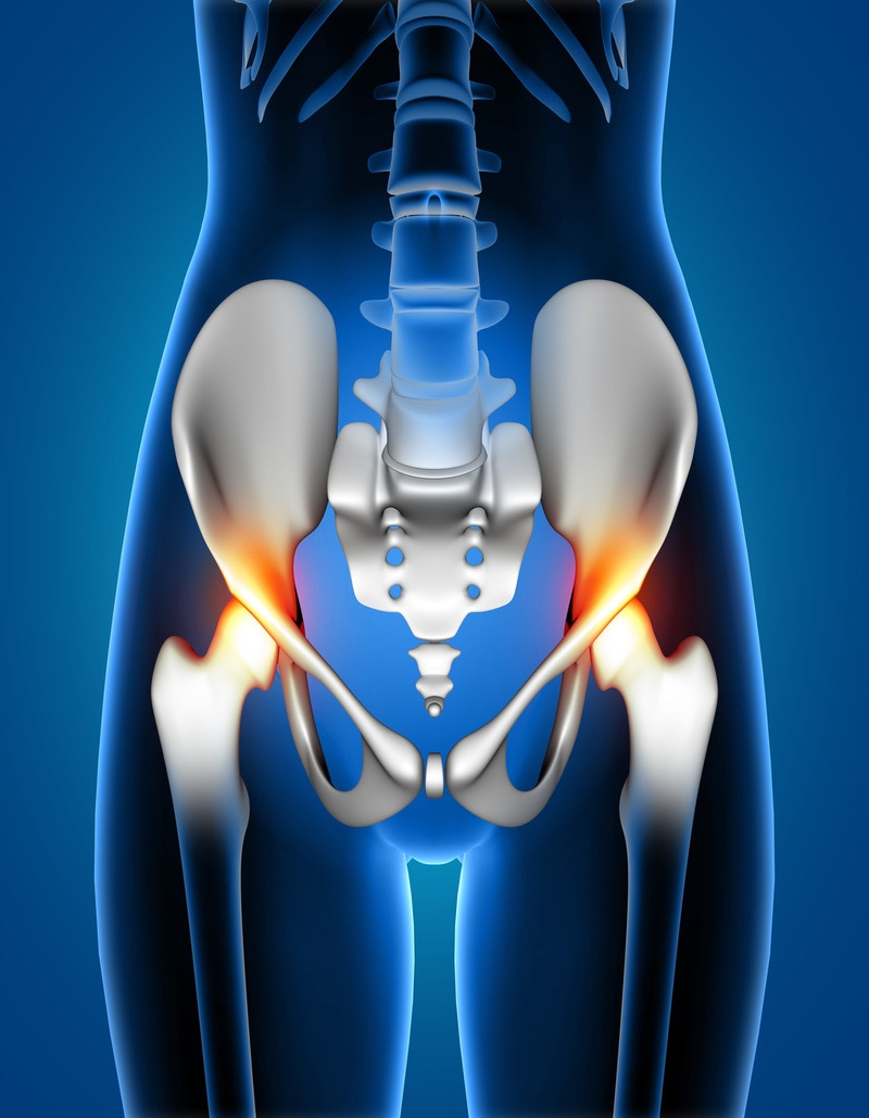 Image of a knee replacement surgery, showing the surgical procedure or results.